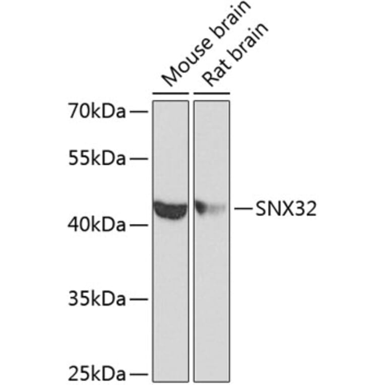 Western Blot - Anti-FLJ30934 Antibody (A12197) - Antibodies.com
