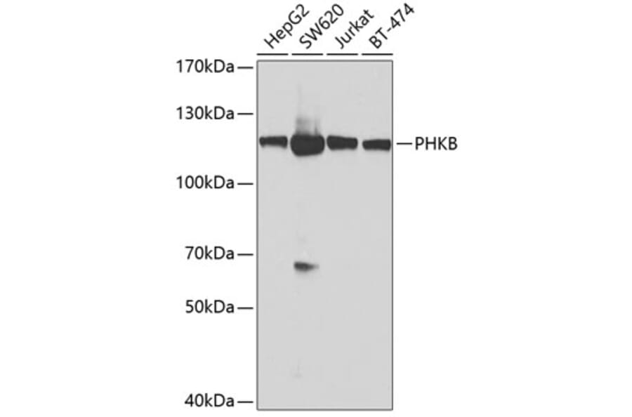 Western Blot - Anti-Phosphorylase B/PHKB Antibody (A12198) - Antibodies.com