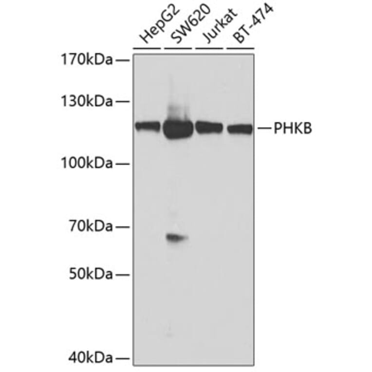 Western Blot - Anti-Phosphorylase B/PHKB Antibody (A12198) - Antibodies.com