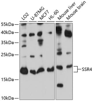 Western blot analysis of extracts of various cell lines, using Anti-SSR4 Antibody (A8037) at 1:1,000 dilution.
Secondary antibody: Goat Anti-Rabbit IgG (H+L) (HRP) (AS014) at 1:10,000 dilution.
Lysates / proteins: 25µg per lane.
Blocking buffer: 3% non-fat dry milk in TBST.
Detection: ECL Basic Kit (RM00020).
Exposure time: 5s.