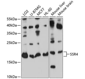 Western Blot - Anti-SSR4 Antibody (A12200) - Antibodies.com