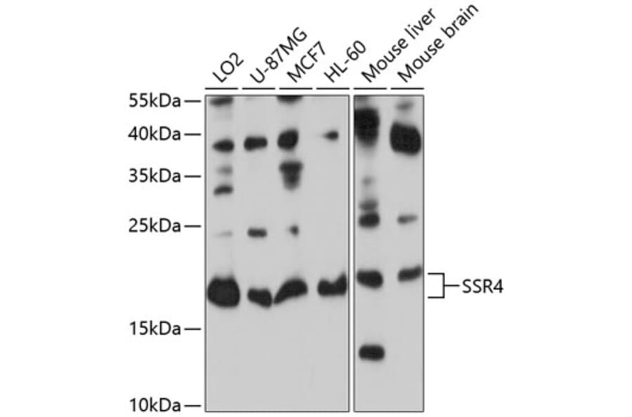 Western Blot - Anti-SSR4 Antibody (A12200) - Antibodies.com