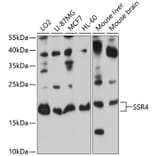 Western Blot - Anti-SSR4 Antibody (A12200) - Antibodies.com