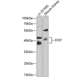 Western Blot - Anti-Syntaxin 7 Antibody (A12201) - Antibodies.com