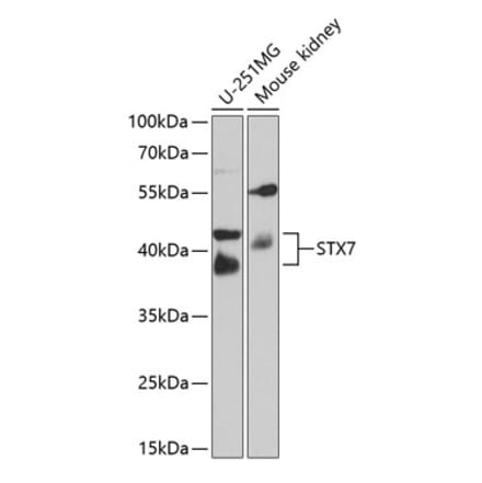 Western Blot - Anti-Syntaxin 7 Antibody (A12201) - Antibodies.com