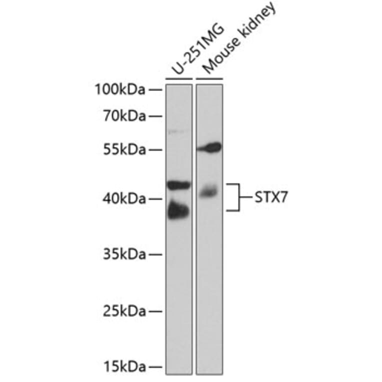 Western Blot - Anti-Syntaxin 7 Antibody (A12201) - Antibodies.com