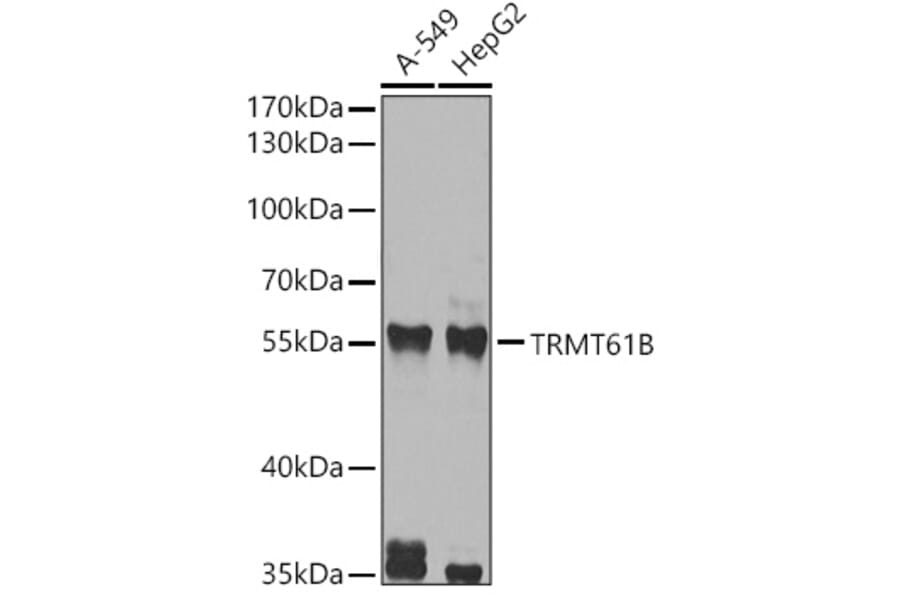Western Blot - Anti-TRMT61B Antibody (A12202) - Antibodies.com