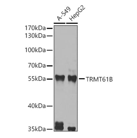 Western Blot - Anti-TRMT61B Antibody (A12202) - Antibodies.com