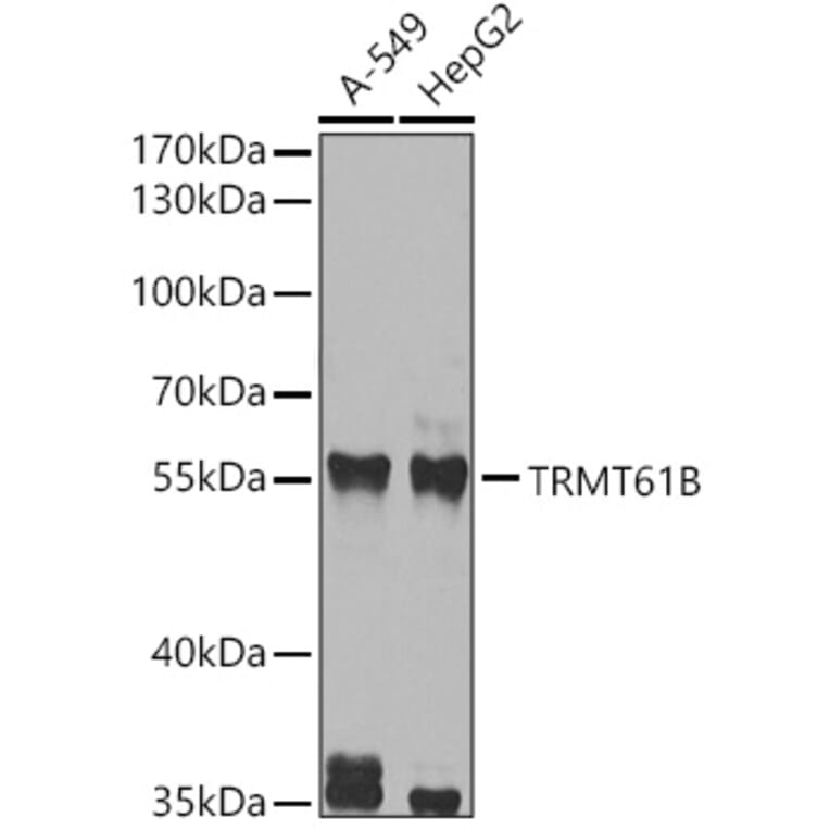 Western Blot - Anti-TRMT61B Antibody (A12202) - Antibodies.com