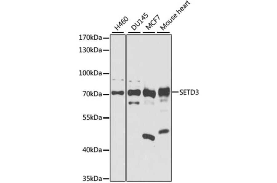 Western Blot - Anti-SETD3 Antibody (A8071) - Antibodies.com