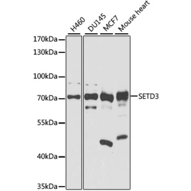Western Blot - Anti-SETD3 Antibody (A8071) - Antibodies.com