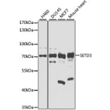 Western Blot - Anti-SETD3 Antibody (A8071) - Antibodies.com