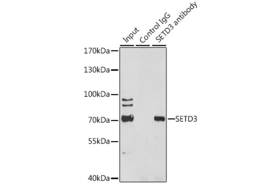 Immunoprecipitation - Anti-SETD3 Antibody (A8071) - Antibodies.com