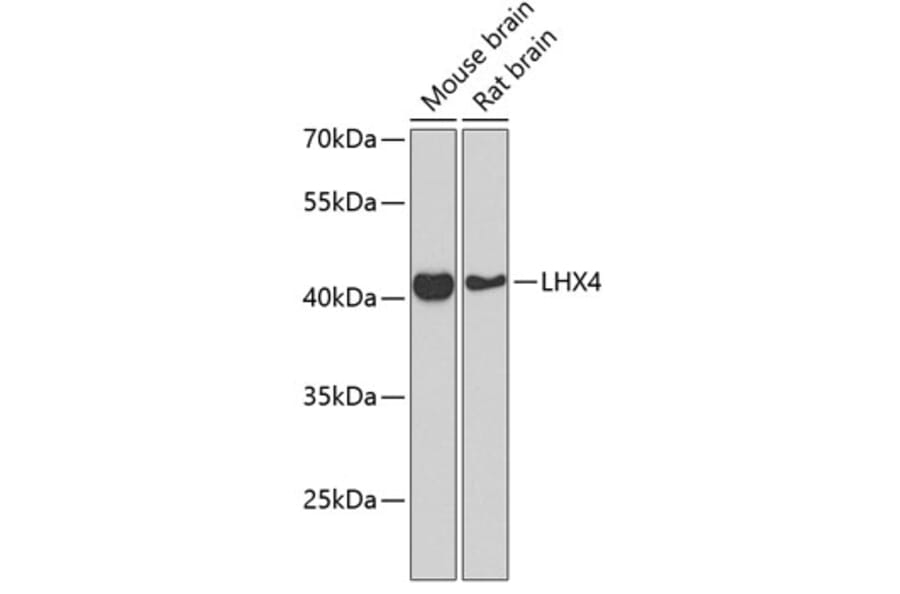 Western Blot - Anti-Lhx4 Antibody (A12204) - Antibodies.com