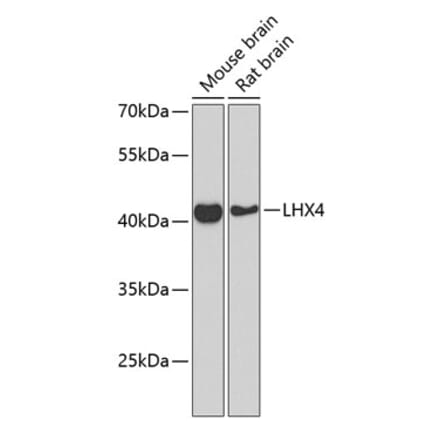 Western Blot - Anti-Lhx4 Antibody (A12204) - Antibodies.com