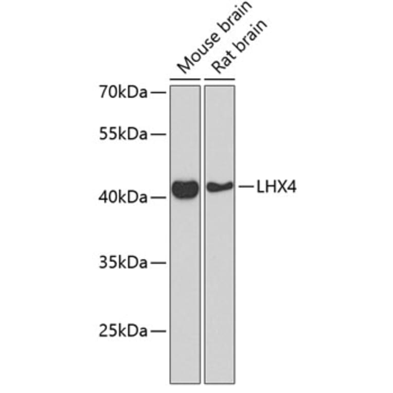 Western Blot - Anti-Lhx4 Antibody (A12204) - Antibodies.com