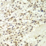 Immunohistochemistry - Anti-Lhx4 Antibody (A12204) - Antibodies.com