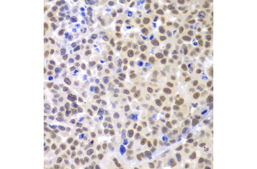Immunohistochemistry - Anti-Lhx4 Antibody (A12204) - Antibodies.com