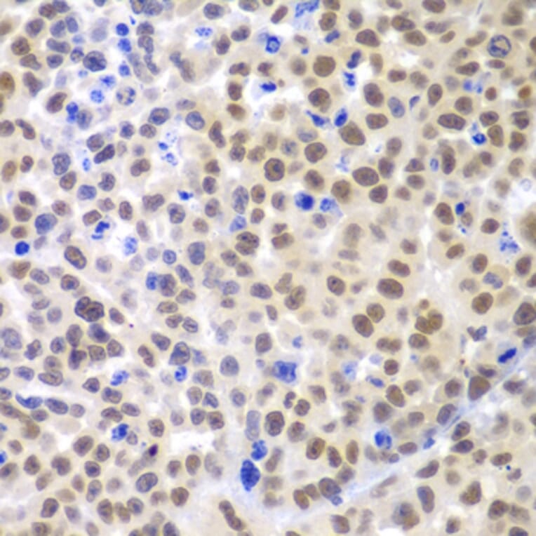 Immunohistochemistry - Anti-Lhx4 Antibody (A12204) - Antibodies.com