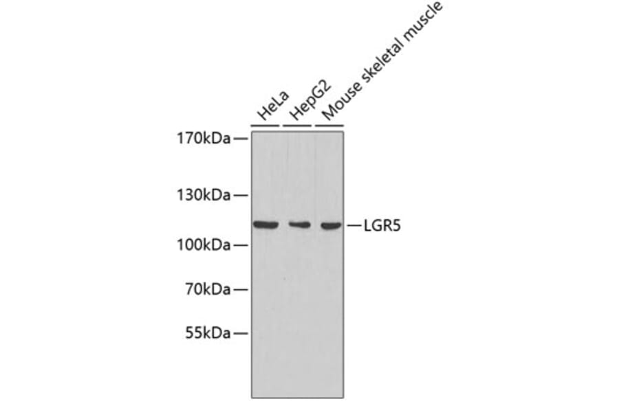 Western Blot - Anti-LGR5 Antibody (A8090) - Antibodies.com