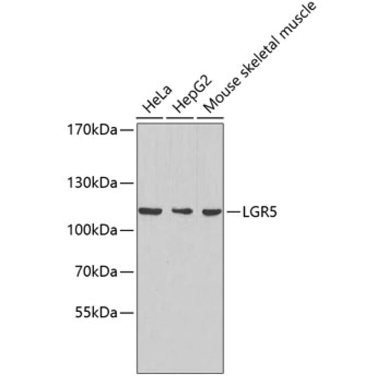 Western Blot - Anti-LGR5 Antibody (A8090) - Antibodies.com