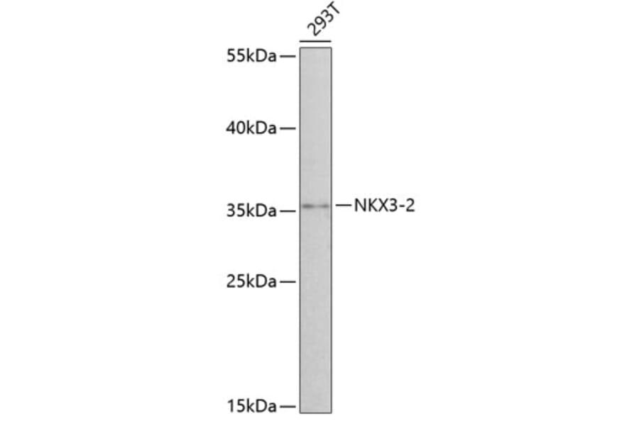 Western Blot - Anti-NKX3-2 Antibody (A8093) - Antibodies.com