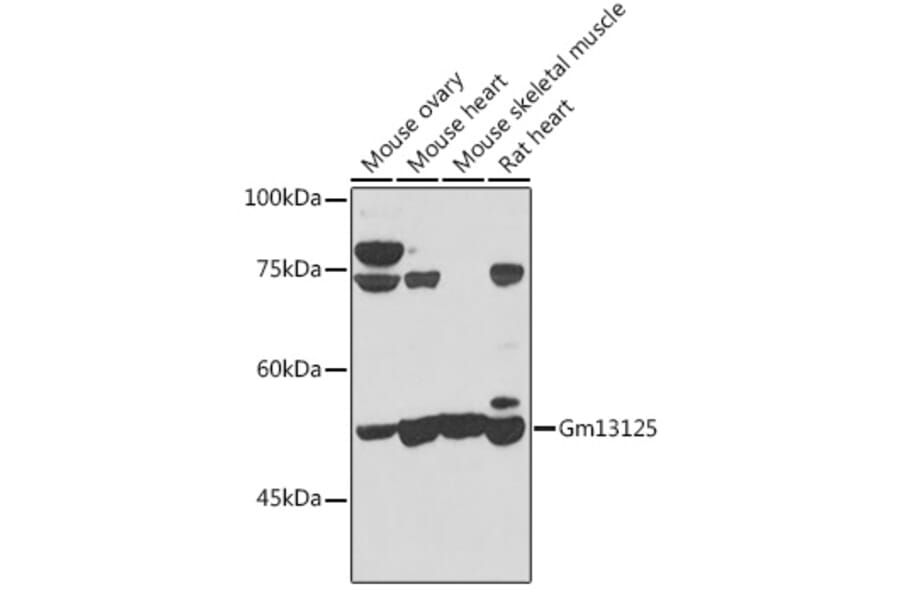 Western Blot - Anti-PRAMEF20 Antibody (A12208) - Antibodies.com
