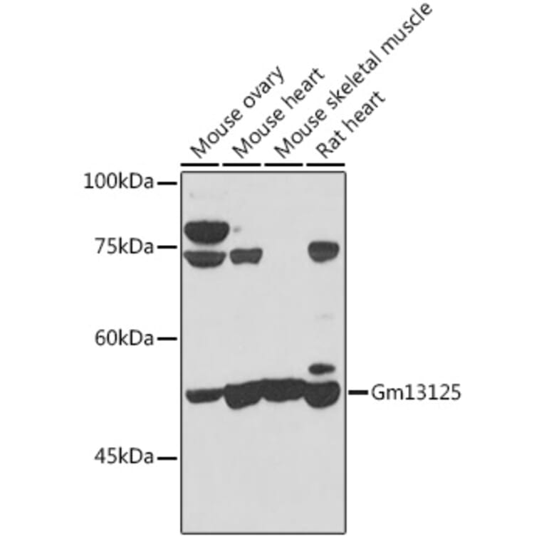 Western Blot - Anti-PRAMEF20 Antibody (A12208) - Antibodies.com