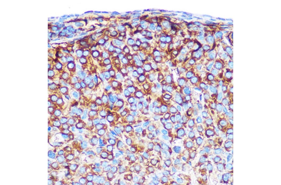 Immunohistochemistry - Anti-PRAMEF20 Antibody (A12208) - Antibodies.com