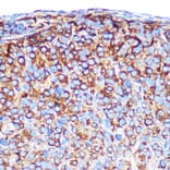 Immunohistochemistry - Anti-PRAMEF20 Antibody (A12208) - Antibodies.com