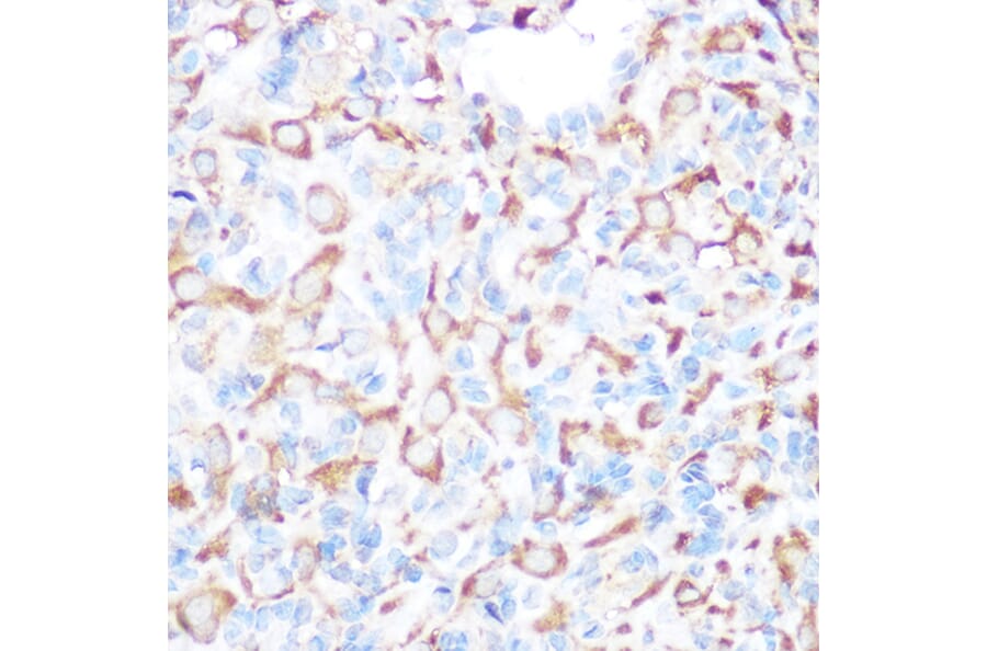 Immunohistochemistry - Anti-PRAMEF20 Antibody (A12208) - Antibodies.com