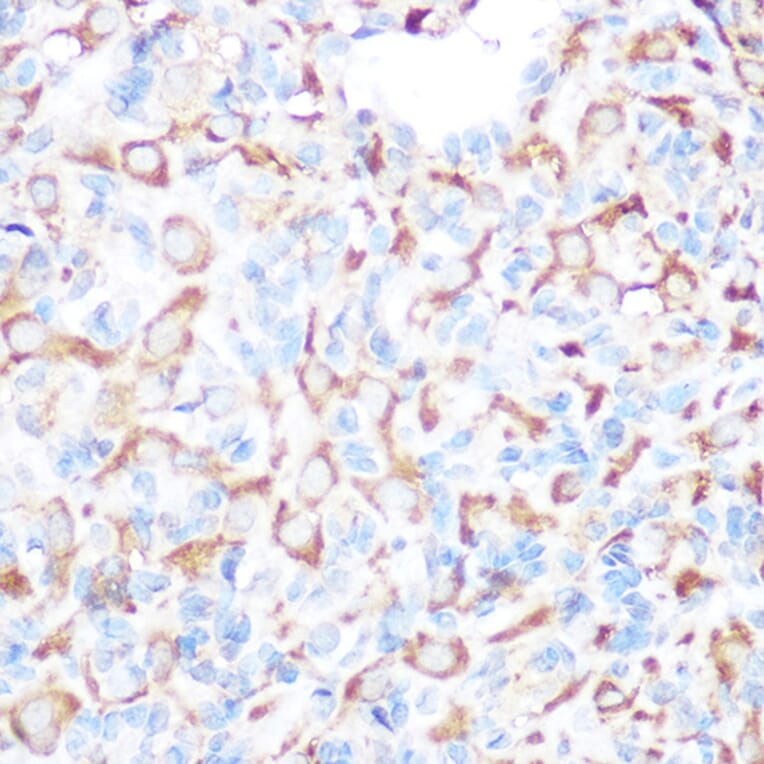Immunohistochemistry - Anti-PRAMEF20 Antibody (A12208) - Antibodies.com