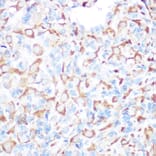 Immunohistochemistry - Anti-PRAMEF20 Antibody (A12208) - Antibodies.com