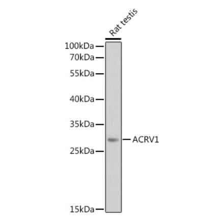 Western Blot - Anti-ACRV1 Antibody (A12209) - Antibodies.com