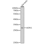 Western Blot - Anti-ACRV1 Antibody (A12209) - Antibodies.com