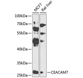 Western Blot - Anti-CEACAM7 Antibody (A12211) - Antibodies.com
