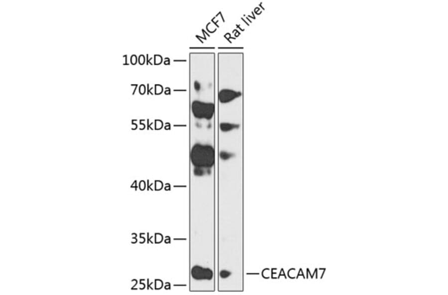 Western Blot - Anti-CEACAM7 Antibody (A12211) - Antibodies.com
