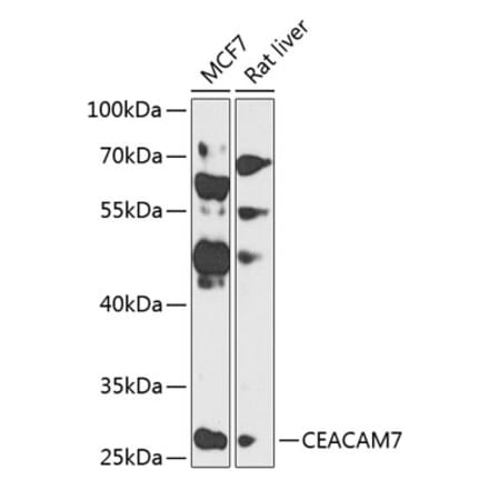 Western Blot - Anti-CEACAM7 Antibody (A12211) - Antibodies.com
