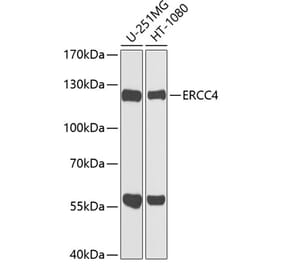 Western Blot - Anti-XPF Antibody (A12212) - Antibodies.com