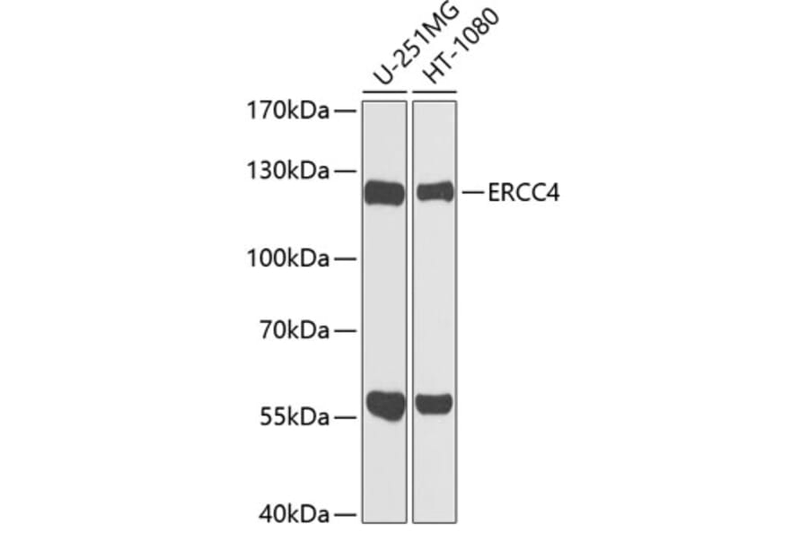 Western Blot - Anti-XPF Antibody (A12212) - Antibodies.com