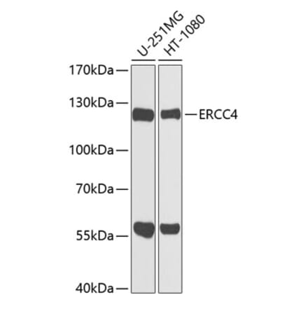 Western Blot - Anti-XPF Antibody (A12212) - Antibodies.com
