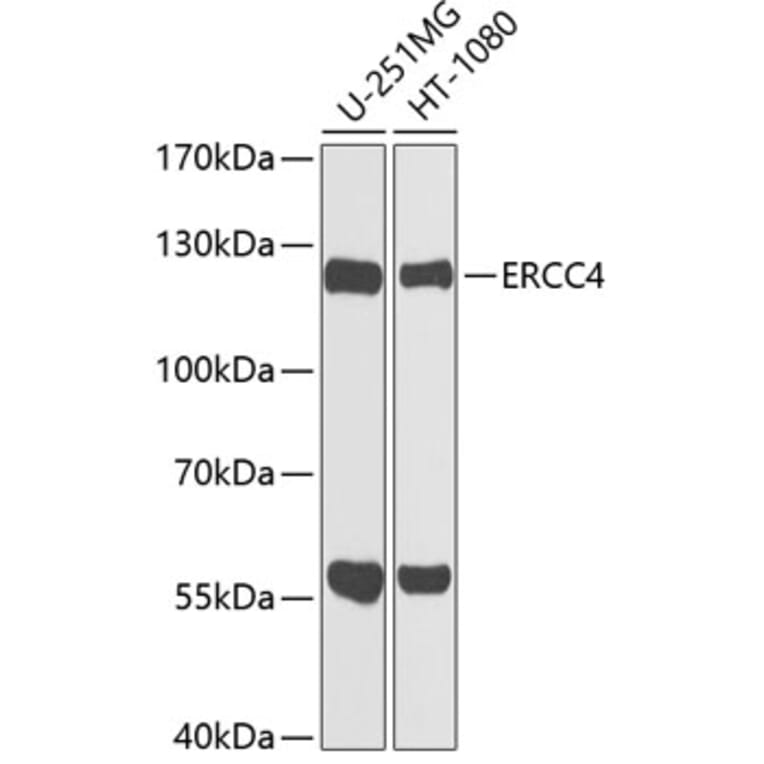 Western Blot - Anti-XPF Antibody (A12212) - Antibodies.com