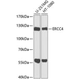 Western Blot - Anti-XPF Antibody (A12212) - Antibodies.com
