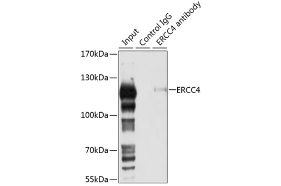 Western Blot - Anti-XPF Antibody (A12212) - Antibodies.com