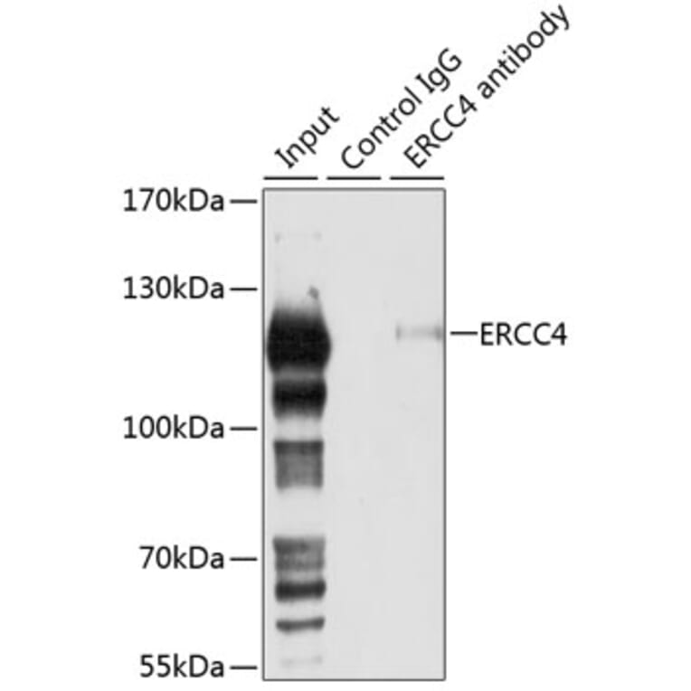 Western Blot - Anti-XPF Antibody (A12212) - Antibodies.com