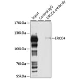 Western Blot - Anti-XPF Antibody (A12212) - Antibodies.com