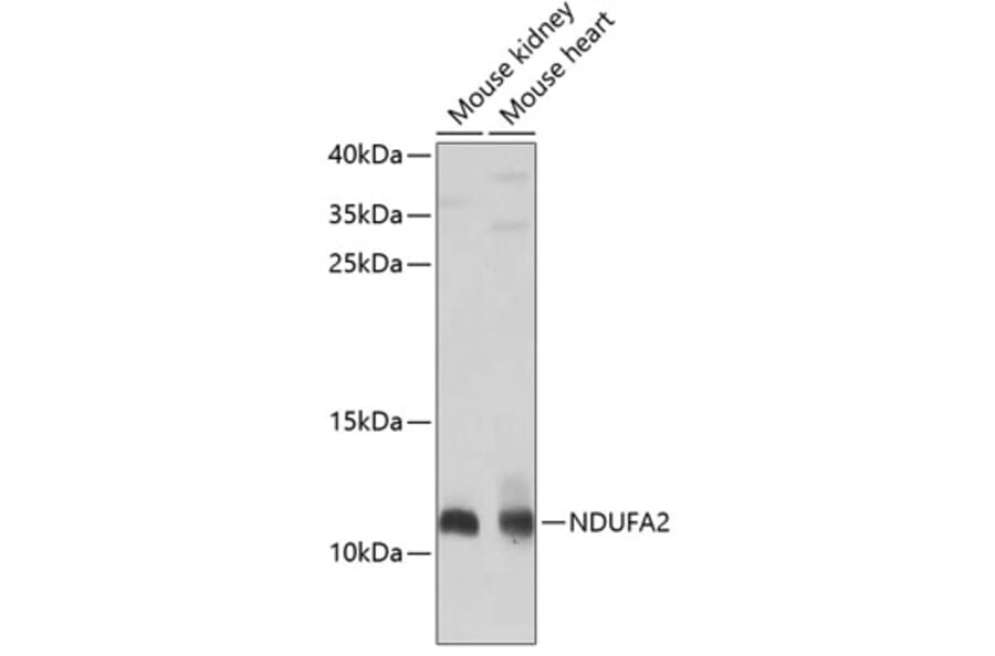 Western Blot - Anti-NDUFA2 Antibody (A12213) - Antibodies.com
