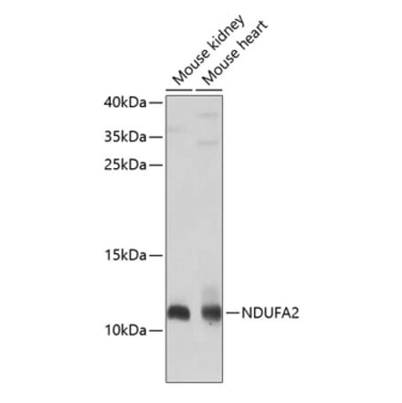 Western Blot - Anti-NDUFA2 Antibody (A12213) - Antibodies.com