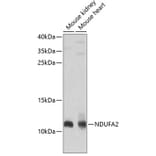 Western Blot - Anti-NDUFA2 Antibody (A12213) - Antibodies.com