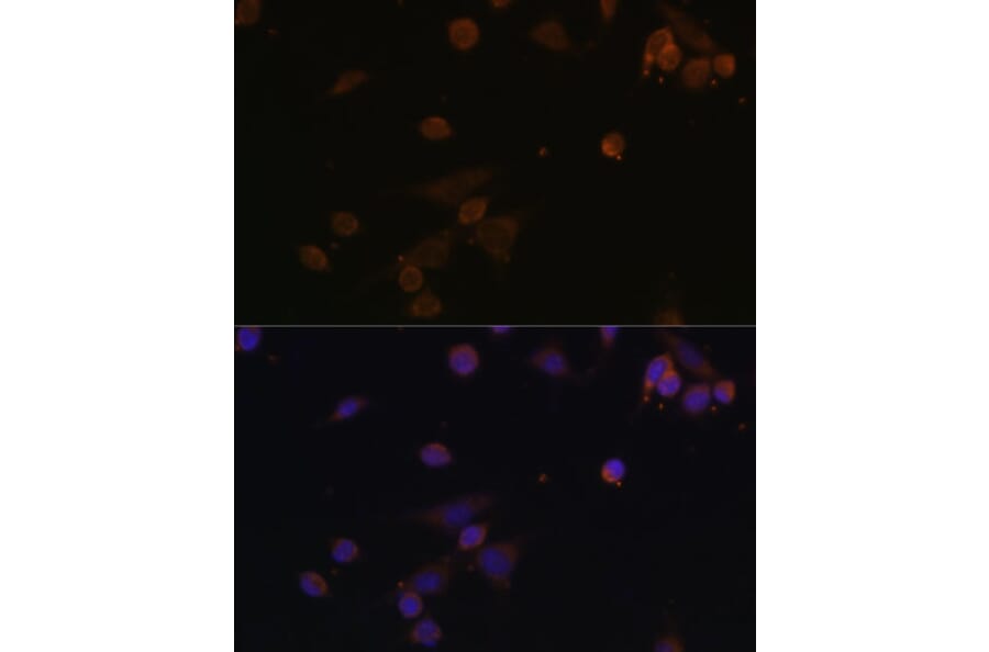 Immunofluorescence - Anti-NDUFA2 Antibody (A12213) - Antibodies.com